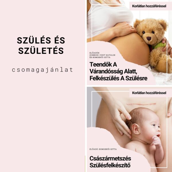 szülés és születés csomagajánlat Epelus.hu